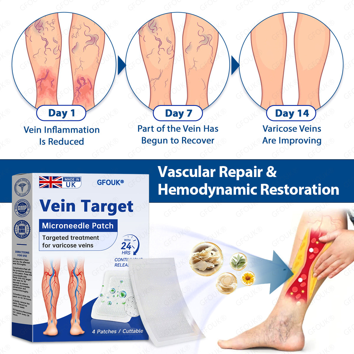 ⚡✅GFOUK® VeinTarget Microneedle Patch👨🏼‍⚕️Instant Relief, Long-Term Results