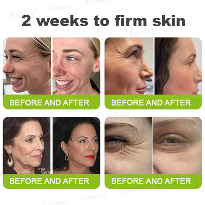 Made and shipped from the UK Rolimey® 💰 Botox & Vita-A Retinol Shot Wrinkle-Lift Tightening cream - Last Day Promotion 70% OFF |✅