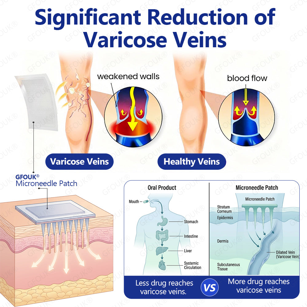 ⚡✅GFOUK® VeinTarget Microneedle Patch👨🏼‍⚕️Instant Relief, Long-Term Results