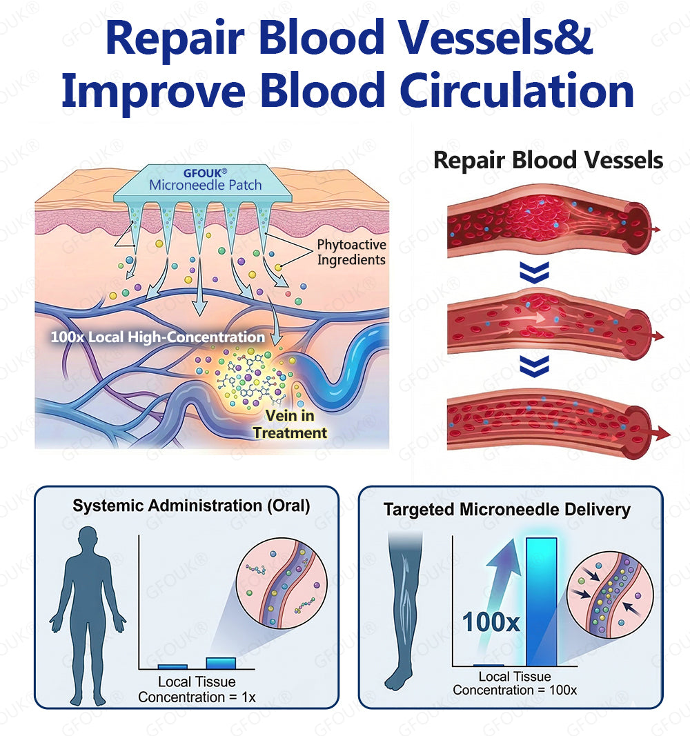 ⚡✅GFOUK® VeinTarget Microneedle Patch👨🏼‍⚕️Instant Relief, Long-Term Results