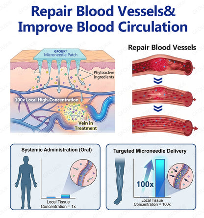 ⚡✅GFOUK® VeinTarget Microneedle Patch👨🏼‍⚕️Instant Relief, Long-Term Results