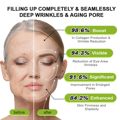 Made and shipped from the UK Rolimey® 💰 Botox & Vita-A Retinol Shot Wrinkle-Lift Tightening cream - Last Day Promotion 70% OFF |✅