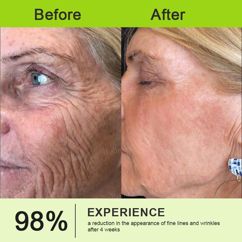 👨‍⚕️⏰Made and shipped from the UK  Rolimey® Botox & Vita-A Retinol Shot Wrinkle-Lift Tightening stick
