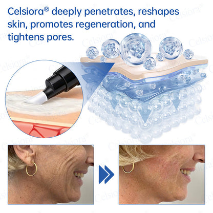 🥈💚💫Celsiora® Botox & PDRN Anti-Wrinkle Shot – Lift & Firming Cream