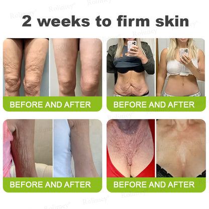 Made and shipped from the UK Rolimey® 💰 Botox & Vita-A Retinol Shot Wrinkle-Lift Tightening cream - Last Day Promotion 70% OFF |✅