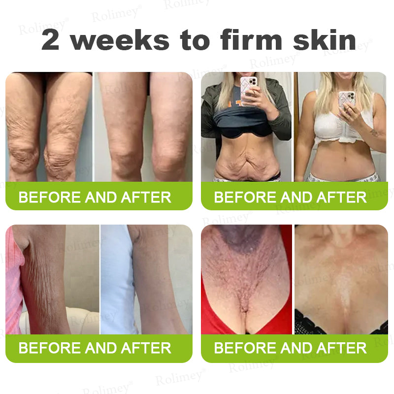 👨‍⚕️⏰Made and shipped from the UK  Rolimey® Botox & Vita-A Retinol Shot Wrinkle-Lift Tightening stick