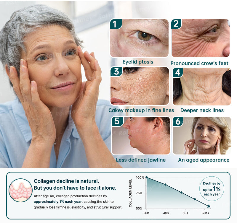 ✨ Rolimey® Botox & Stem Cell Wrinkle-Lift Tightening Cream (upsell)