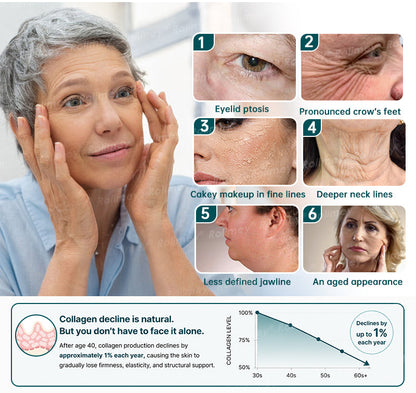 ✨ Rolimey® Botox & Stem Cell Wrinkle-Lift Tightening Cream (upsell)