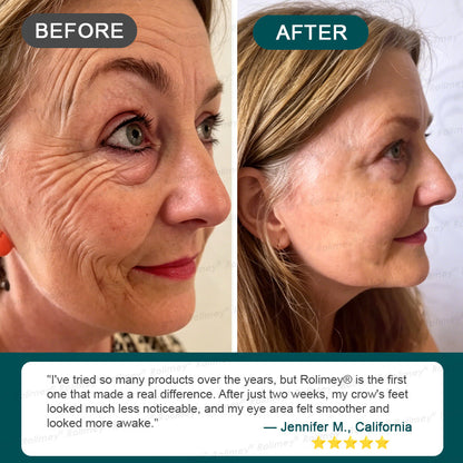 ✨ Rolimey® Botox & Stem Cell Wrinkle-Lift Tightening Cream (upsell)