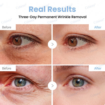 🥈💚💫Celsiora® Botox & PDRN Anti-Wrinkle Shot – Lift & Firming Cream