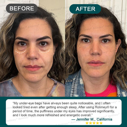 ✨ Rolimey® Botox & Stem Cell Wrinkle-Lift Tightening Cream (upsell)