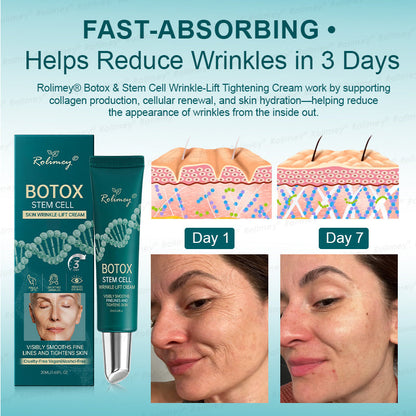 ✨ Rolimey® Botox & Stem Cell Wrinkle-Lift Tightening Cream (upsell)
