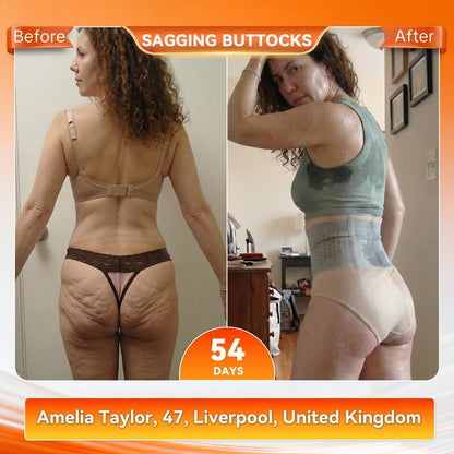 💞𝐌𝐨𝐫𝐢𝐧𝐠𝐚 & 𝐁𝐞𝐫𝐛𝐞𝐫𝐢𝐧𝐞 4‑In‑1 Micro‑Particle Sculpting & Fat‑Burn Shorts