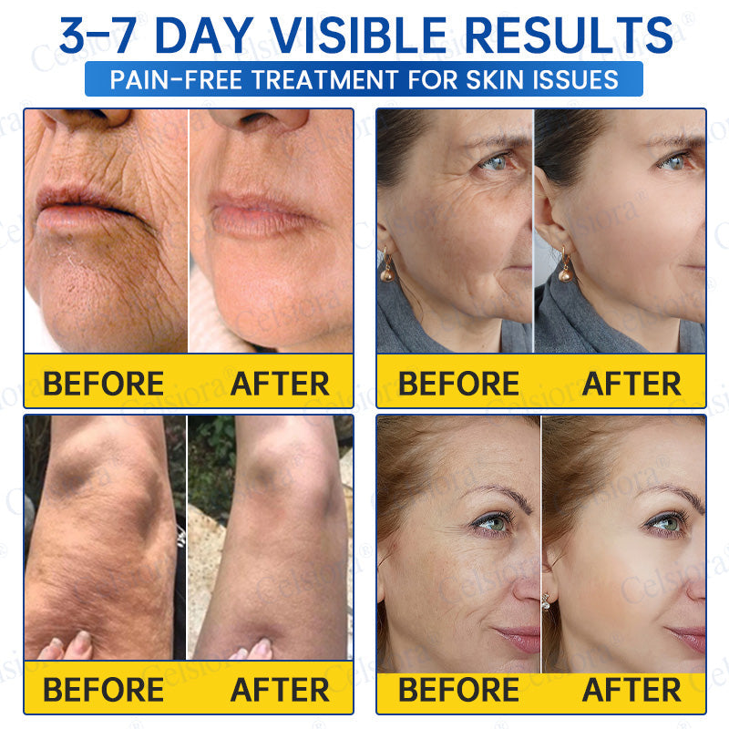 🥈💚💫Celsiora® Botox & PDRN Anti-Wrinkle Shot – Lift & Firming Cream