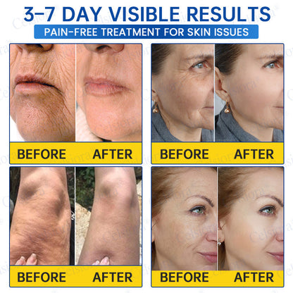 🥈💚💫Celsiora® Botox & PDRN Anti-Wrinkle Shot – Lift & Firming Cream