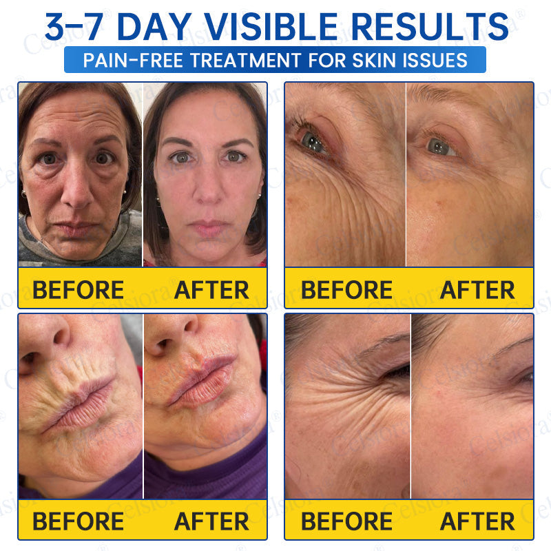🥈💚💫Celsiora® Botox & PDRN Anti-Wrinkle Shot – Lift & Firming Cream
