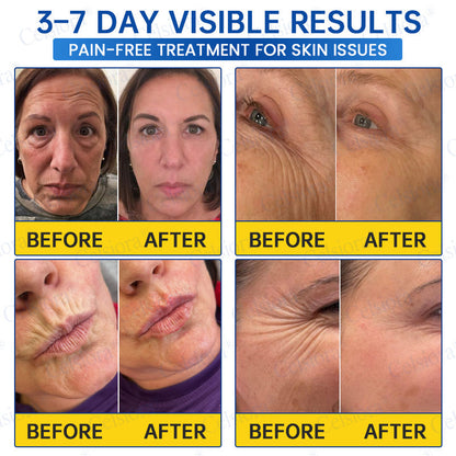🥈💚💫Celsiora® Botox & PDRN Anti-Wrinkle Shot – Lift & Firming Cream