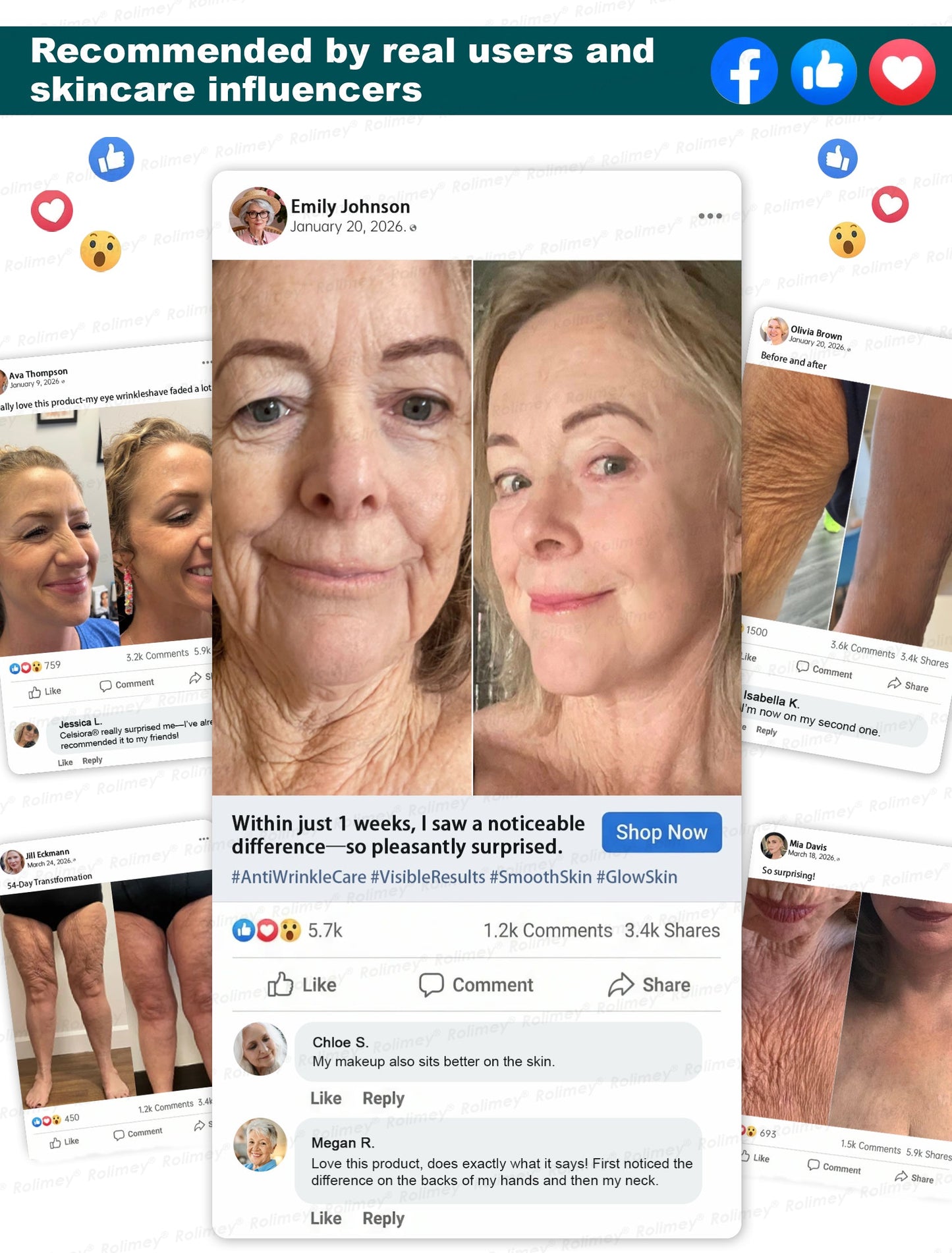 ✨ Rolimey® Botox & Stem Cell Wrinkle-Lift Tightening Cream (upsell)