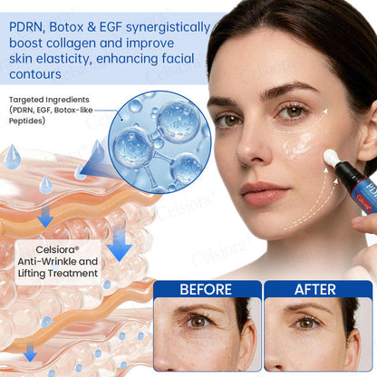 🥈💚💫Celsiora® Botox & PDRN Anti-Wrinkle Shot – Lift & Firming Cream